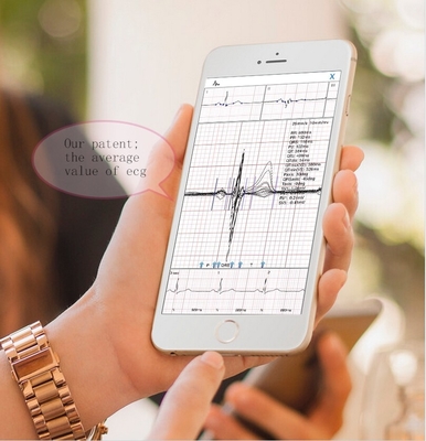 WIFI Smart Mobile ECG Machine iPhone iCV200 With Cardio Device