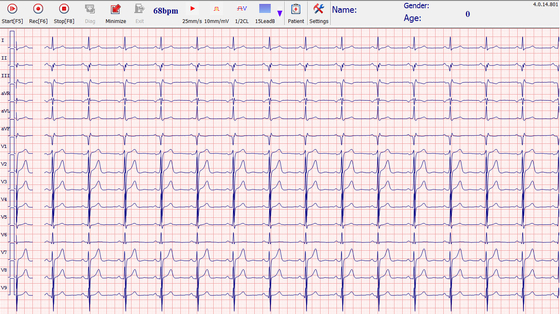 Smart 12 Channel ECG Machine for PC based ECG Device with Fan Type Box