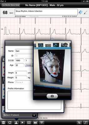 12 Lead Wireless ECG Machine