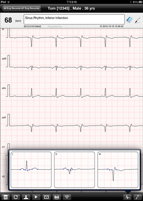 12 Lead Wireless ECG Machine