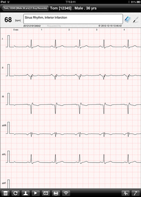 12 Lead Wireless ECG Machine