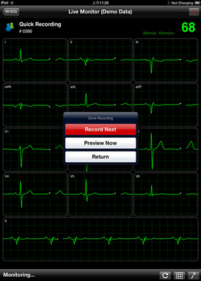 Cardiac Stress System 12 channel Digital ECG Machine , Hand Held ECG