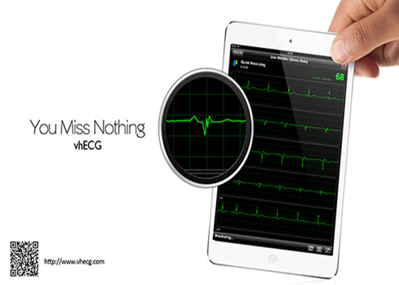 Wireless Mobile ECG Machine