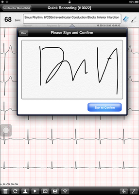 Wireless Mobile ECG Machine