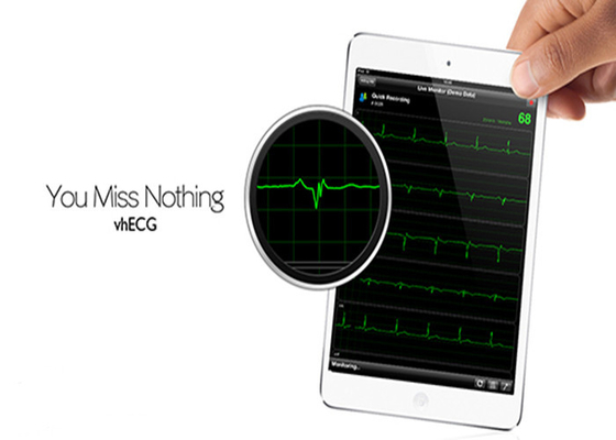Heart ECG Test Bluetooth Electrocardiogram Equipment For IOS System