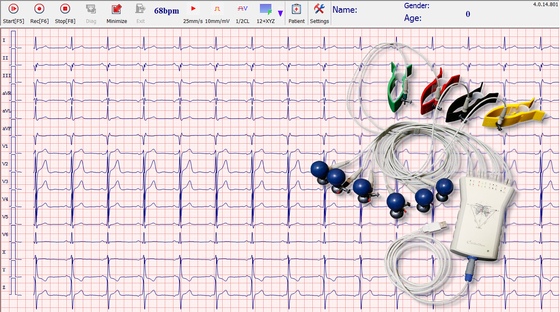 Handheld ECG Machine with Grey Pocket ECG Recorder USB Cable to Windows System